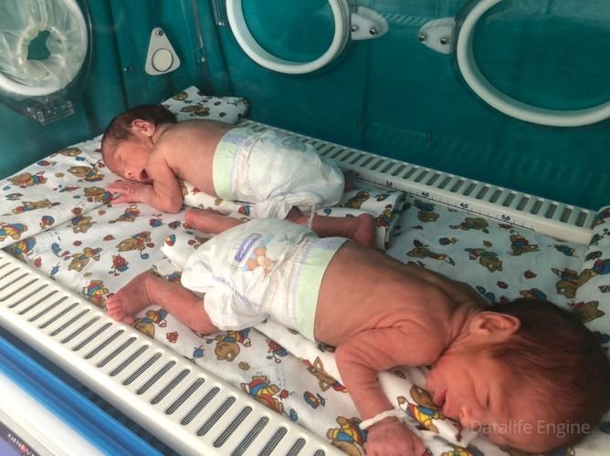 Qubada vaxtından əvvəl doğulan əkiz uşaqların həyatı xilas edilib