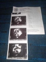 “İstərdim oğlumu Rəşad Mahmudov əməliyyat etsin, amma maddi imkanım çatmır” - Prezidentə müraciət olundu