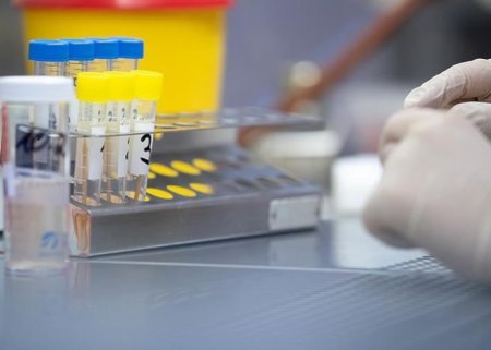 ABŞ-da meymunçiçəyinə 21 yoluxma qeydə alındı