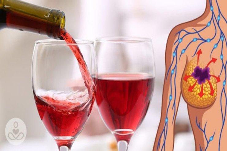 Şərab içmək döş xərçənginə səbəb olur 